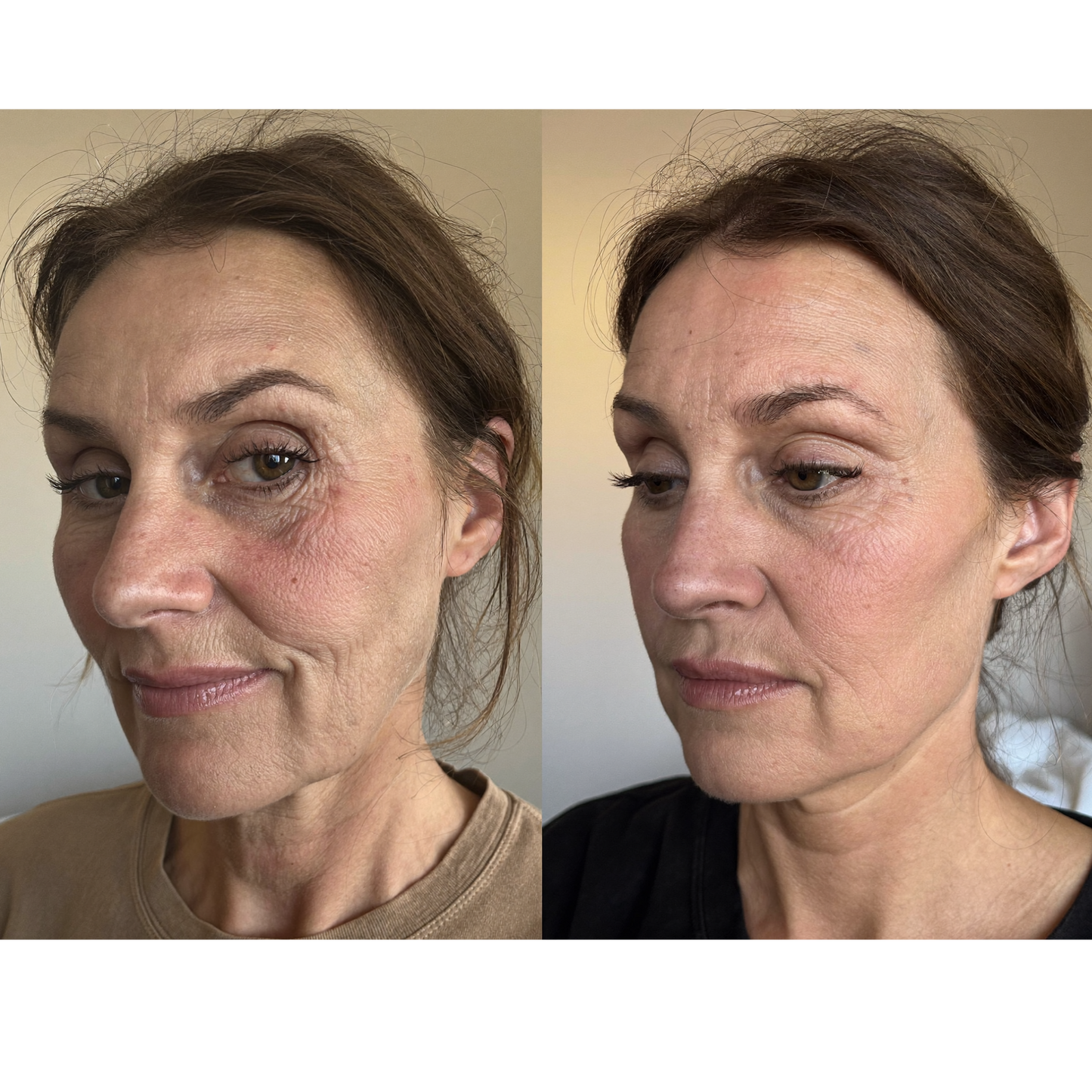 Tempurix Solution Mask