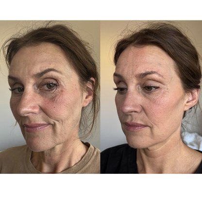 Tempurix Solution Mask