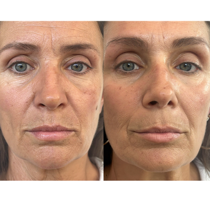 Tempurix Solution Mask